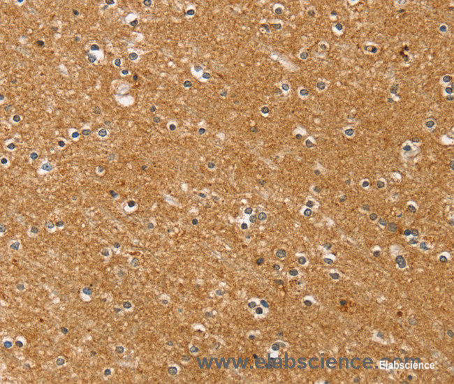 Immunohistochemistry of paraffin-embedded Human brain tissue using SYTL5 Polyclonal Antibody at dilution 1:50