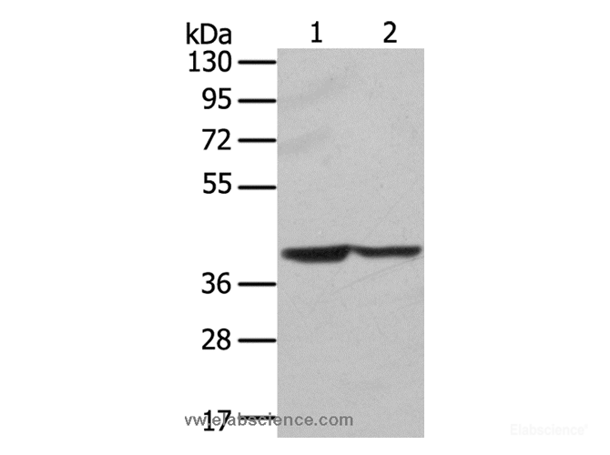 Western Blot analysis of Hela and hepg2 cell using STX16 Polyclonal Antibody at dilution of 1:400