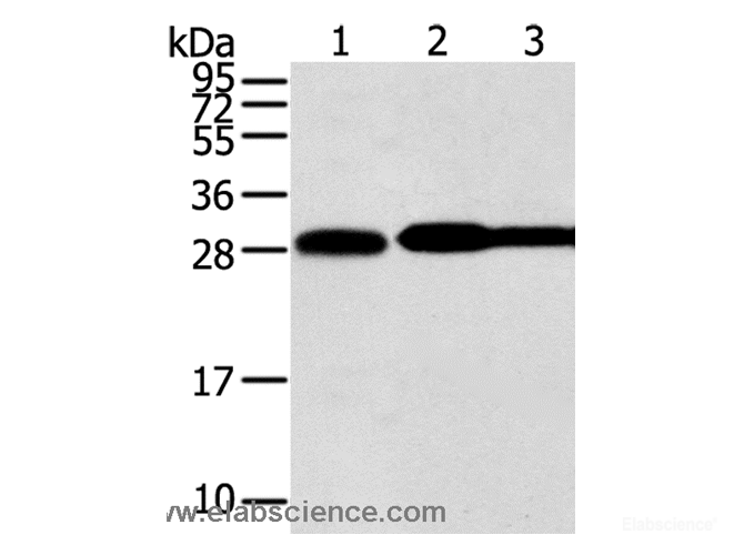 Western Blot analysis of Hela, lovo and A431 cell using STX10 Polyclonal Antibody at dilution of 1:800