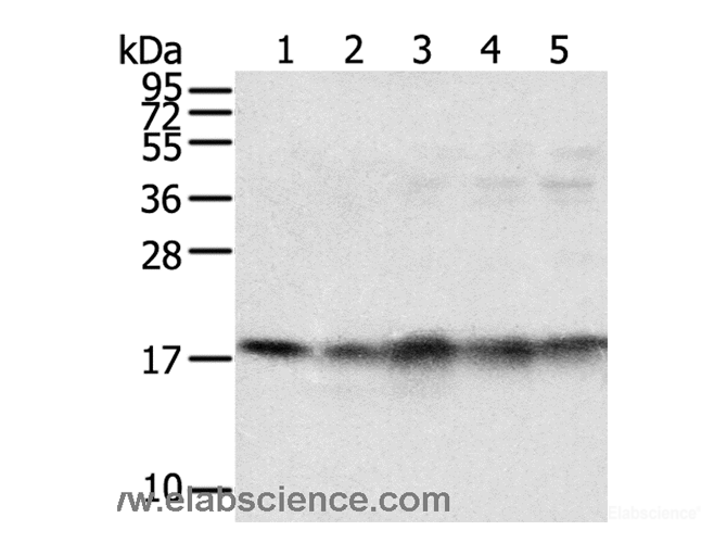 Western Blot analysis of Mouse brain and heart tissue, Jurkat, K562 and hela cell using TAF11 Polyclonal Antibody at dilution of 1:800