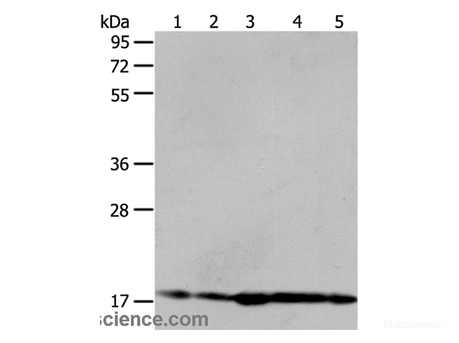 Western Blot analysis of Hela and 293T cell, Mouse liver tissue, A431 and MCF-7 cell using ARF6 Polyclonal Antibody at dilution of 1:450