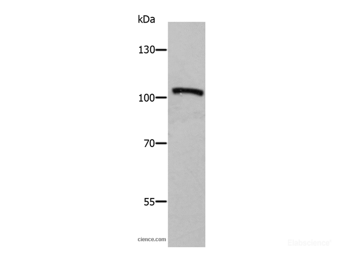Western Blot analysis of Human fetal brain tissue using ADAMTS5 Polyclonal Antibody at dilution of 1:650