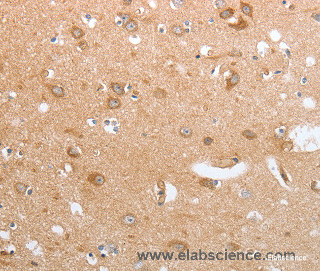 Immunohistochemistry of paraffin-embedded Human brain tissue using CASP12 Polyclonal Antibody at dilution 1:50