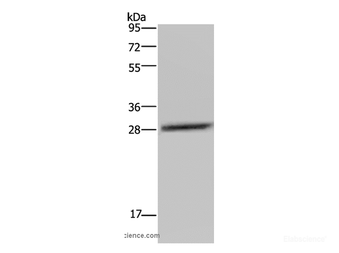 Western Blot analysis of LO2 cell using CEBPD Polyclonal Antibody at dilution of 1:300