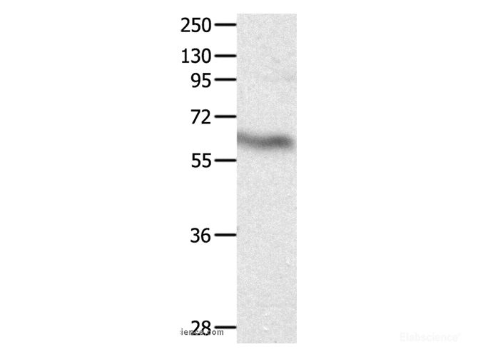 Western Blot analysis of Huamn fetal brain tissue using CRMP3 Polyclonal Antibody at dilution of 1:500