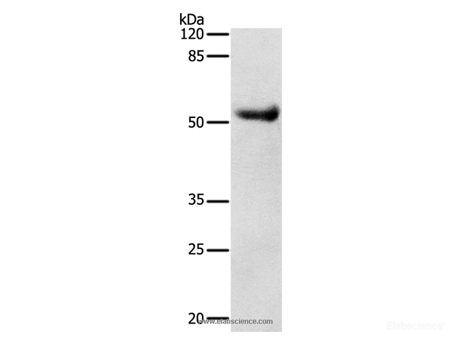 Western Blot analysis of Human liver cancer tissue using DRD4 Polyclonal Antibody at dilution of 1:600