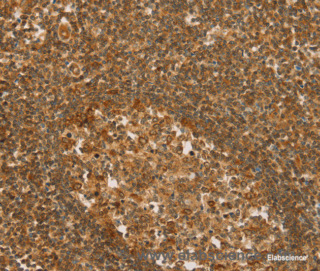 Immunohistochemistry of paraffin-embedded Human tonsil tissue using SLC6A3 Polyclonal Antibody at dilution 1:50