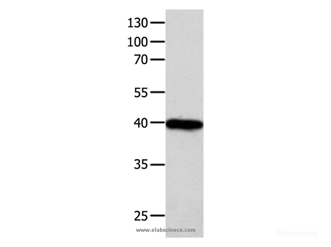 Western Blot analysis of 293T cell using FOXL1 Polyclonal Antibody at dilution of 1:850