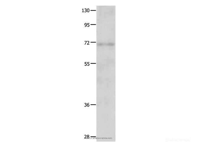 Western Blot analysis of Human fetal lung tissue using IGF2BP1 Polyclonal Antibody at dilution of 1:500
