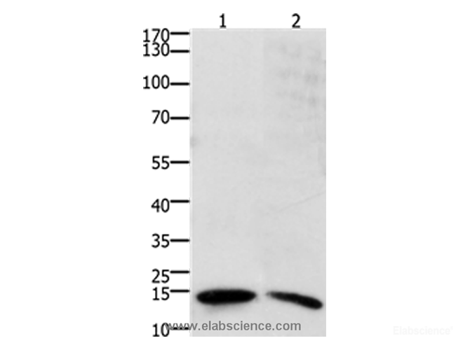 Western Blot analysis of Human ovarian cancer tissue and SKOV3 cell using SUMO2/3/4 Polyclonal Antibody at dilution of 1:800