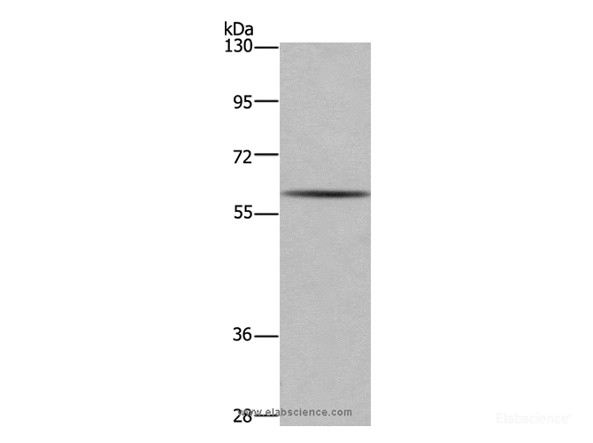 Western Blot analysis of Human fetal brain tissue using GAD1 Polyclonal Antibody at dilution of 1:571