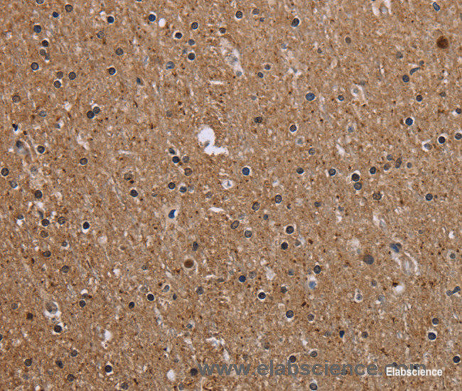Immunohistochemistry of paraffin-embedded Human brain tissue using CMTM5 Polyclonal Antibody at dilution 1:40