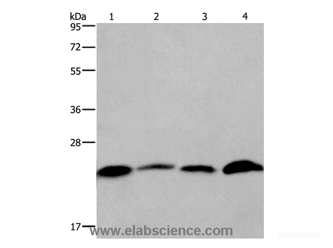 Western Blot analysis of Human placenta and testis tissue, Hela and Raji cell using CMTM6 Polyclonal Antibody at dilution of 1:700
