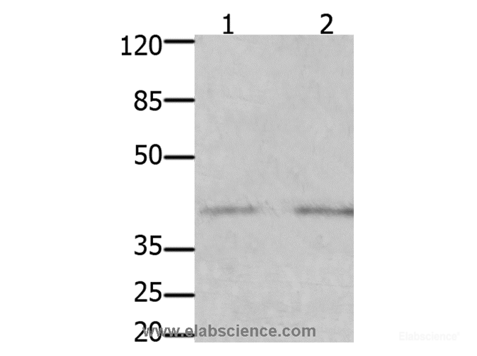 Western Blot analysis of Human fetal kidney and brain tissue using GFRA3 Polyclonal Antibody at dilution of 1:1000
