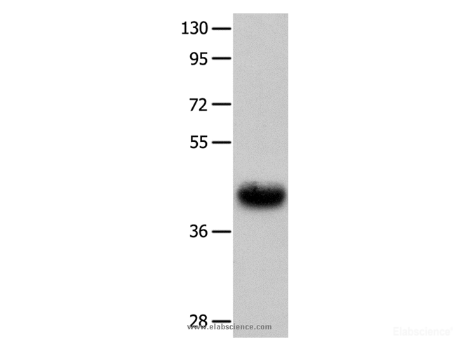 Western Blot analysis of Human fetal muscle tissue using UTS2R Polyclonal Antibody at dilution of 1:400