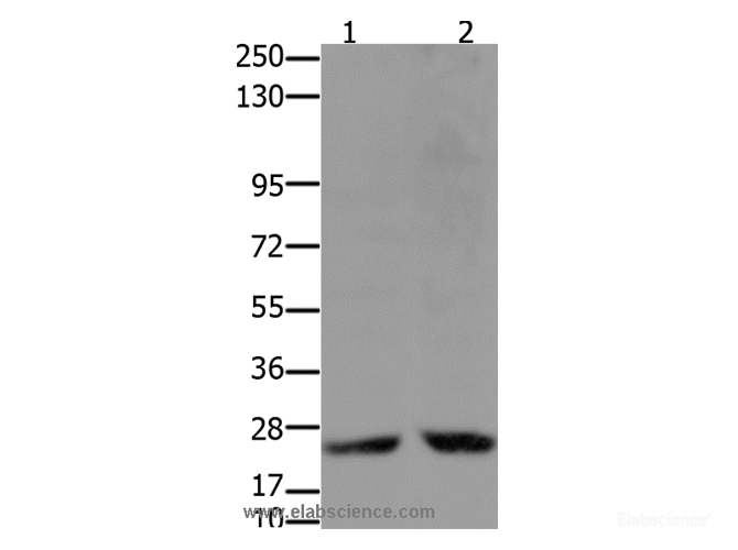 Western Blot analysis of Hela and 231 cell using HMGB2 Polyclonal Antibody at dilution of 1:2000