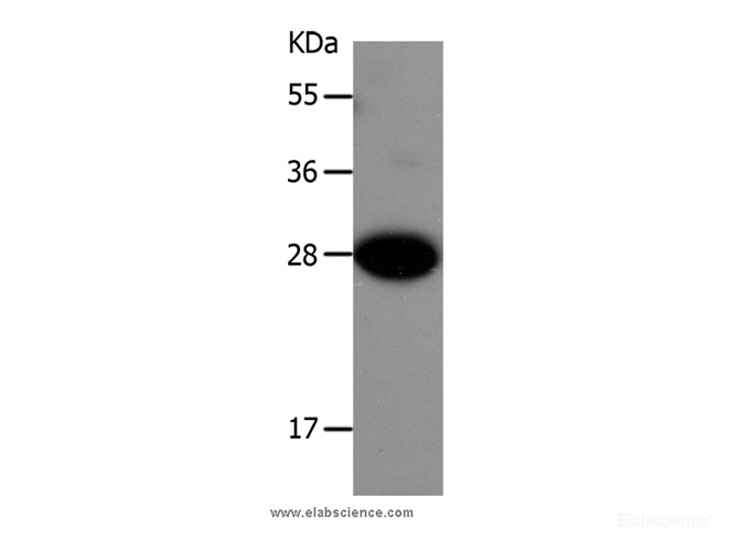 Western Blot analysis of Mouse liver tissue using IGFBP1 Polyclonal Antibody at dilution of 1:550