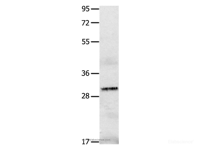 Western Blot analysis of A549 cell using IL2RA Polyclonal Antibody at dilution of 1:750