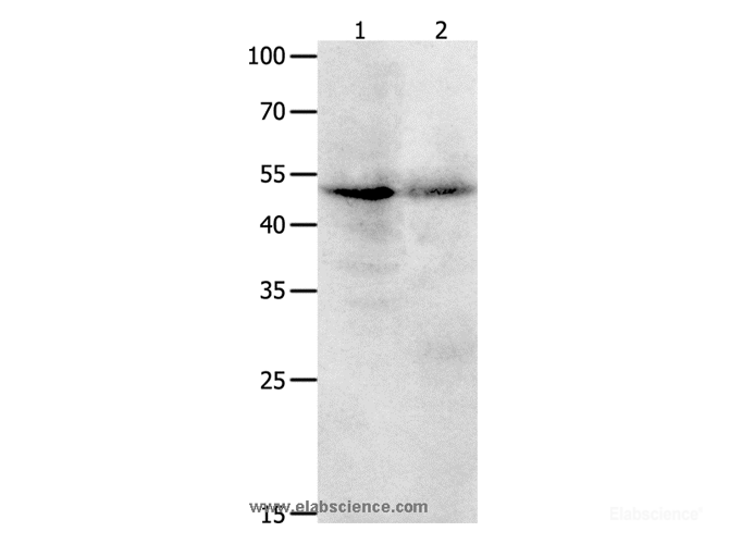 Western Blot analysis of Jurkat cell and Human ovarian cancer tissue using KLF5 Polyclonal Antibody at dilution of 1:1700