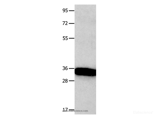 Western Blot analysis of Mouse brain tissue using KLK5 Polyclonal Antibody at dilution of 1:1600