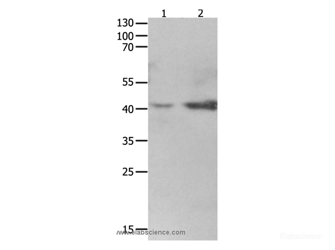 Western Blot analysis of 293T cell and fetal kidney tissue using LRPAP1 Polyclonal Antibody at dilution of 1:1600