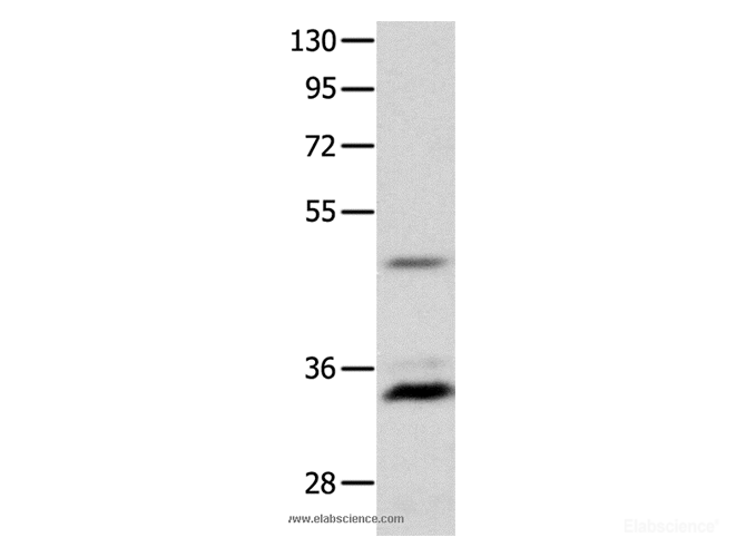 Western Blot analysis of Mouse intestinum tenue tissue using MC1R Polyclonal Antibody at dilution of 1:1450