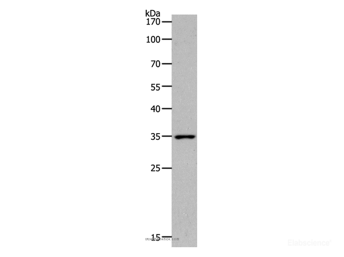 Western Blot analysis of Human fetal kidney tissue using MC2R Polyclonal Antibody at dilution of 1:1400