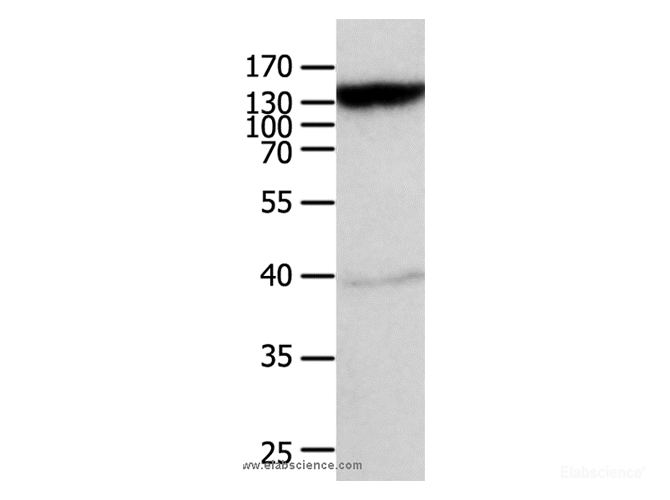 Western Blot analysis of Mouse heart tissue using ABCC5 Polyclonal Antibody at dilution of 1:950