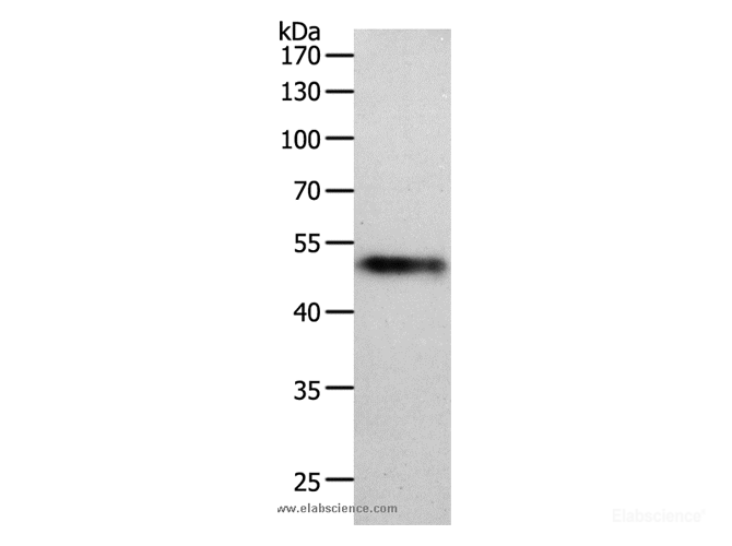 Western Blot analysis of Human lung tissue using MIDN Polyclonal Antibody at dilution of 1:1000