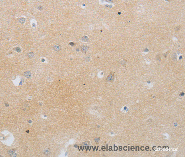 Immunohistochemistry of paraffin-embedded Human brain tissue using MMP25 Polyclonal Antibody at dilution 1:80