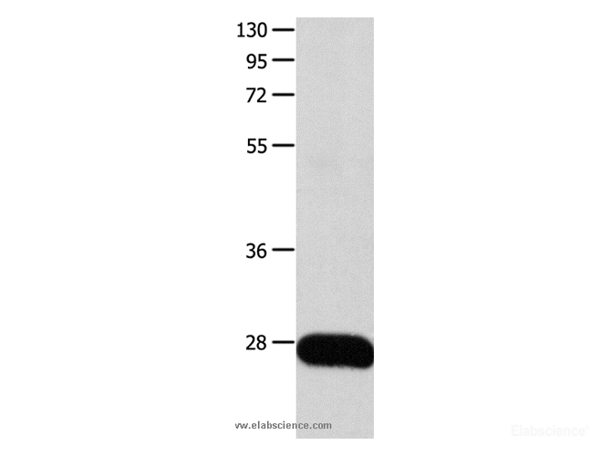 Western Blot analysis of Human liver cancer tissue using POMC Polyclonal Antibody at dilution of 1:450