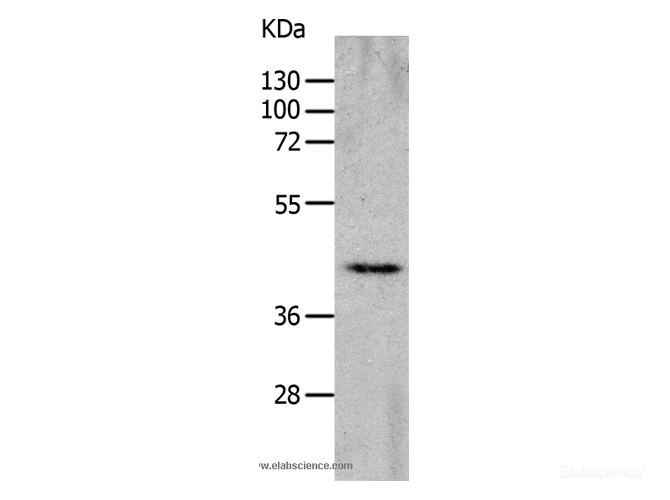 Western Blot analysis of Mouse heart tissue using CHRNA7 Polyclonal Antibody at dilution of 1:700