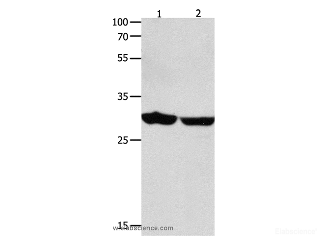 Western Blot analysis of Human brain malignant glioma and laryngocarcinoma tissue using 14-3-3 epsilon Polyclonal Antibody at dilution of 1:1300