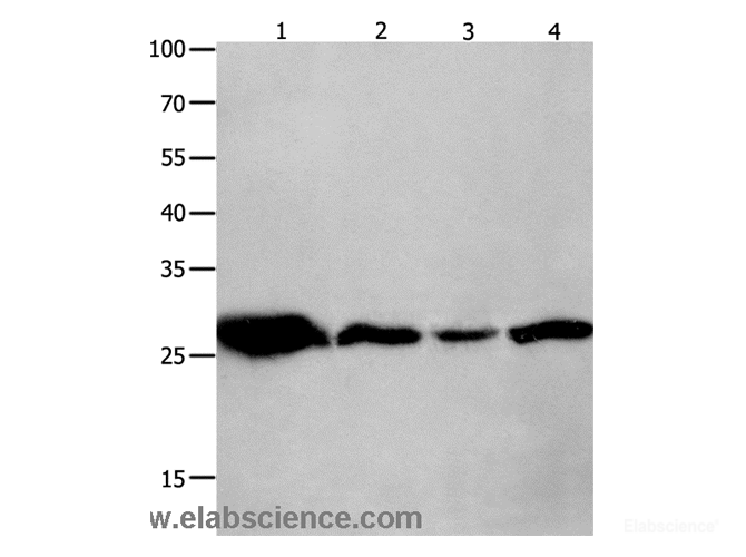 Western Blot analysis of Mouse brain tissue, A549 cell and Human lymphoma tissue, hela cell using 14-3-3 theta Polyclonal Antibody at dilution of 1:950