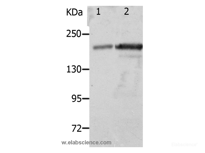 Western Blot analysis of Mouse spleen and kidney tissue using NPHS1 Polyclonal Antibody at dilution of 1:800