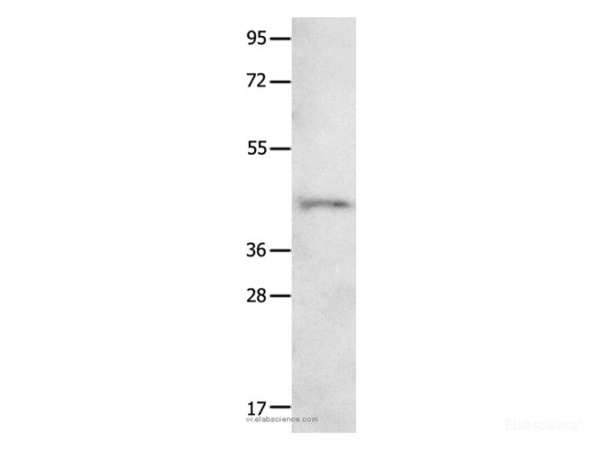 Western Blot analysis of 231 cell using NTSR1 Polyclonal Antibody at dilution of 1:800