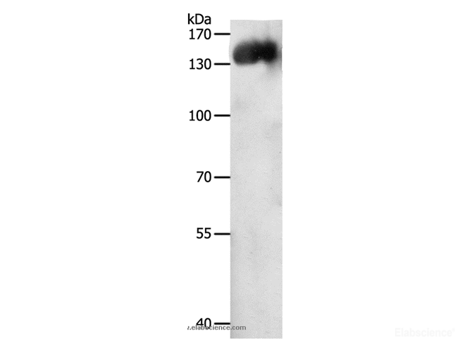Western Blot analysis of Jurkat cell using CD31 Polyclonal Antibody at dilution of 1:500
