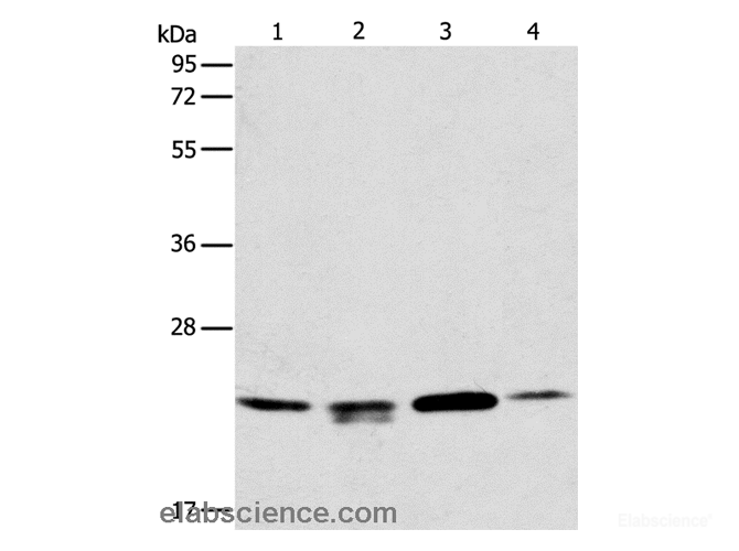 Western Blot analysis of 293T, hela and PC3 cell, Human liver cancer tissue using PRDX2 Polyclonal Antibody at dilution of 1:750
