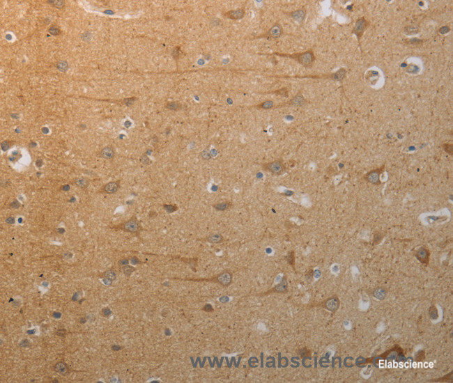Immunohistochemistry of paraffin-embedded Human brain tissue using SLC4A7 Polyclonal Antibody at dilution 1:50