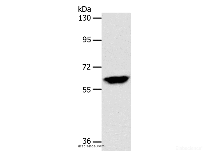 Western Blot analysis of Mouse brain tissue using INA Polyclonal Antibody at dilution of 1:500