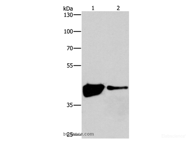Western Blot analysis of 293T and Human fetal brain tissue using MAPK11 Polyclonal Antibody at dilution of 1:200