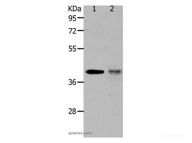 Western Blot analysis of NIH/3T3 cell and Human fetal muscle tissue using TRIM63 Polyclonal Antibody at dilution of 1:1200