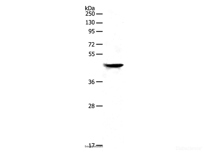 Western Blot analysis of Human brain malignant glioma tissue using NDRG2 Polyclonal Antibody at dilution of 1:950