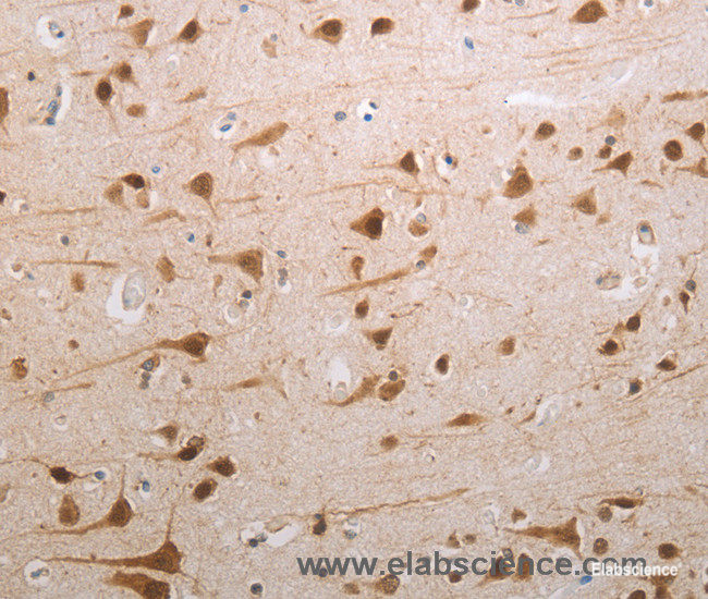 Immunohistochemistry of paraffin-embedded Human brain tissue using MDC1 Polyclonal Antibody at dilution 1:80