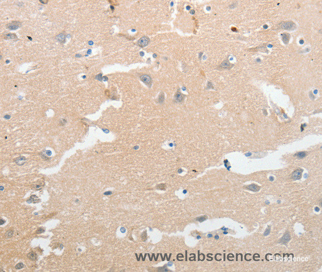 Immunohistochemistry of paraffin-embedded Human brain tissue using LCN2 Polyclonal Antibody at dilution 1:50