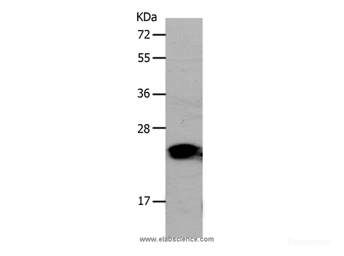 Western Blot analysis of Human liver cancer tissue using PNOC Polyclonal Antibody at dilution of 1:1200