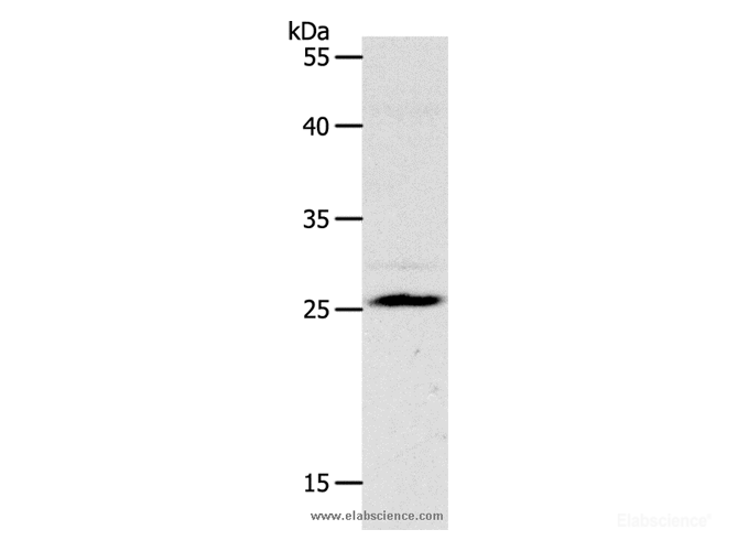 Western Blot analysis of Mouse liver tissue using NQO2 Polyclonal Antibody at dilution of 1:1200