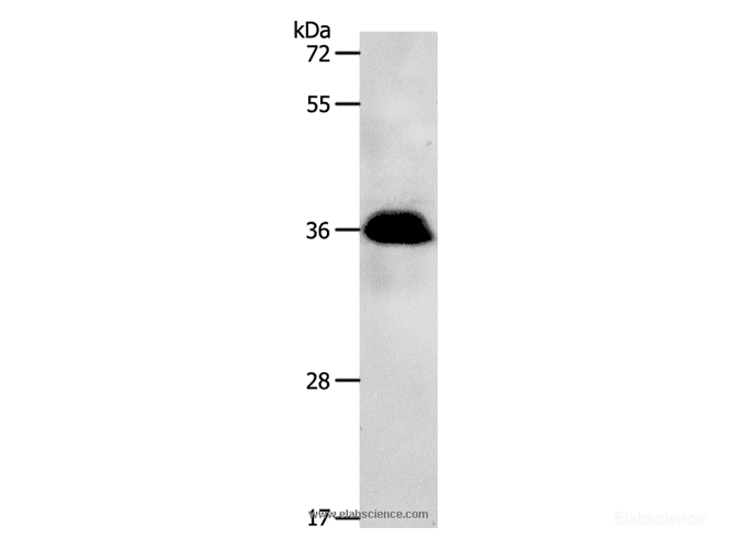 Western Blot analysis of Jurkat cell using PPP2CB Polyclonal Antibody at dilution of 1:1200