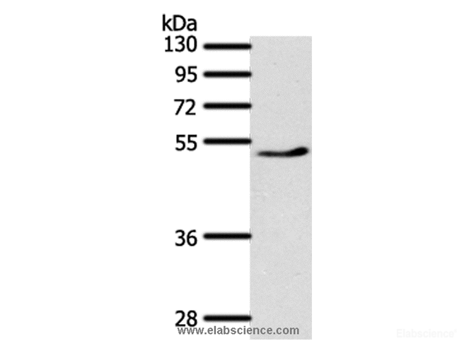 Western Blot analysis of Mouse heart tissue using PPARD Polyclonal Antibody at dilution of 1:500