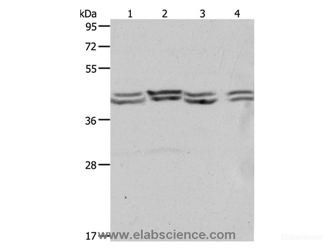 Western Blot analysis of Hela, 293T, NIH/3T3 and Jurkat cell using PSMD6 Polyclonal Antibody at dilution of 1:650